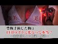 小野准平医師が解説「豊胸手術した胸はLEDライトで光る」主治医の見解は？【東京美容外科公式】