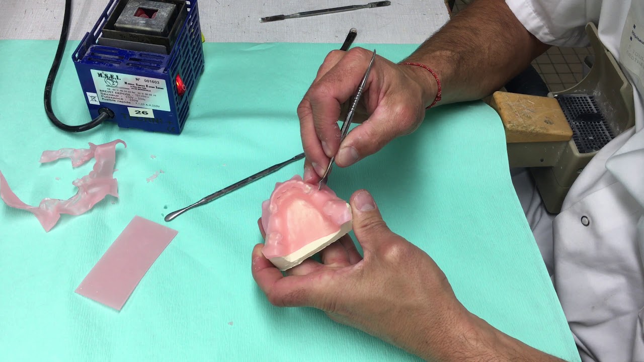 Plaque en cire mandibulaire