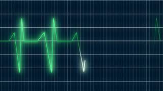 #Футаж кардиограмма  ◄4K•HD► #Footage cardiogram