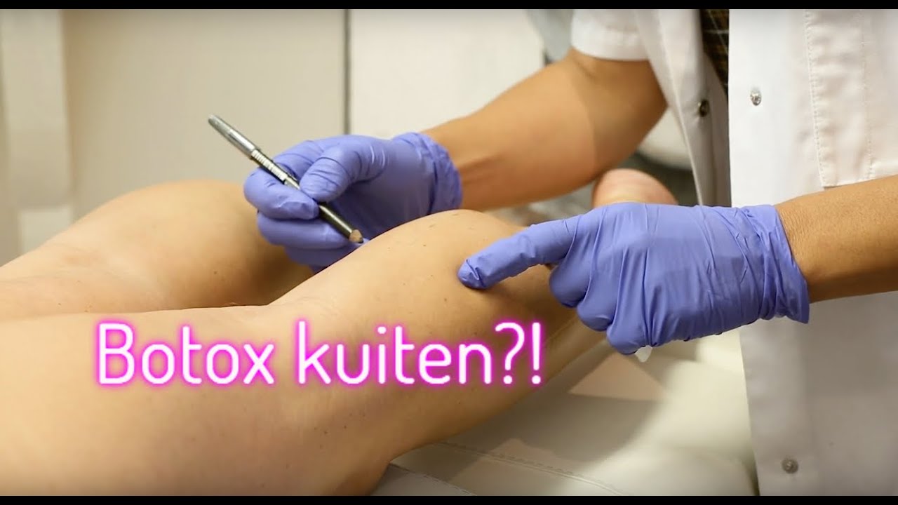 Kuiten smaller maken met botox | FURROW.NL - YouTube