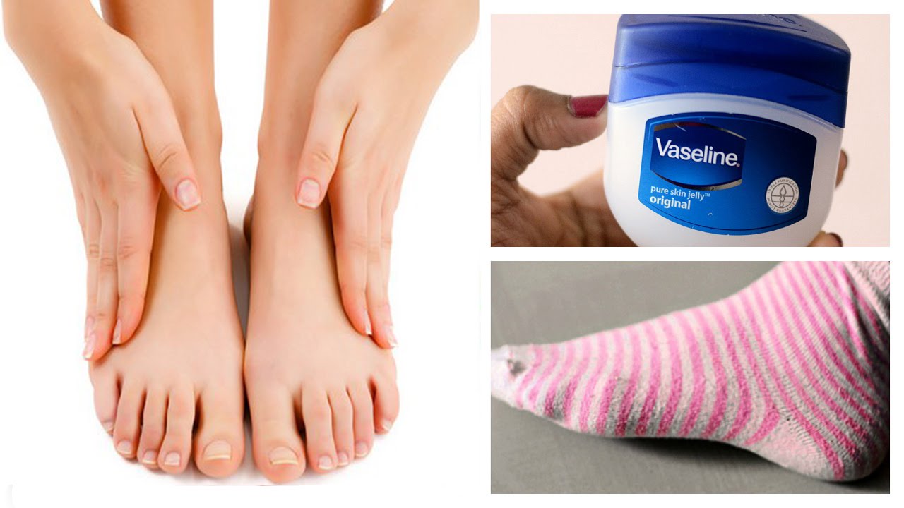 Best Petroleum Jelly For Cracked Heels | Home Remedies For Cracked Heels –  VedaOils