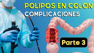 Datos de ALARMA Despues De Quitar Los Pólipos  y Seguimiento Por Colonoscopia | Parte 3