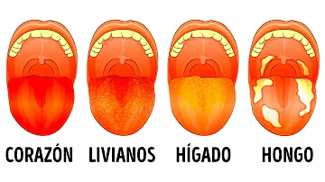 ¿Qué dice tu lengua sobre tu salud?
