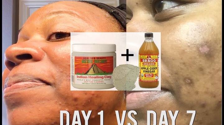 How to use Aztec clay mask with apple cider vinegar