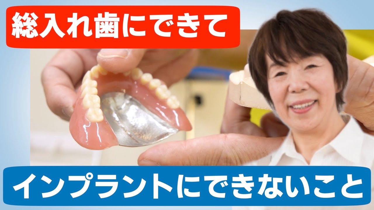 総入れ歯かインプラントか悩んでいる方へ！総入れ歯の費用と治療期間メリットデメリットまとめ