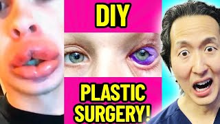 Plastic Surgeon Reveals DIY Plastic Surgery HORROR Stories!