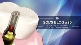 In a quest for ultimate abutment screw channel sealing material. Sol's video blog #10