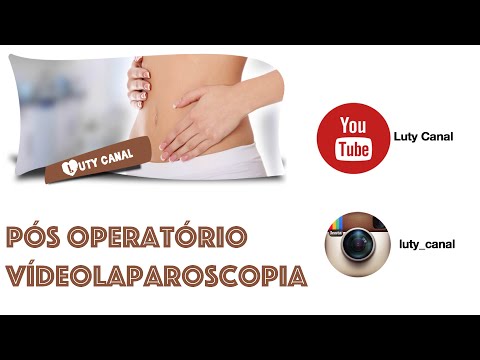 Vídeo: Laparoscopia: Finalidade, Preparação, Procedimento E Recuperação