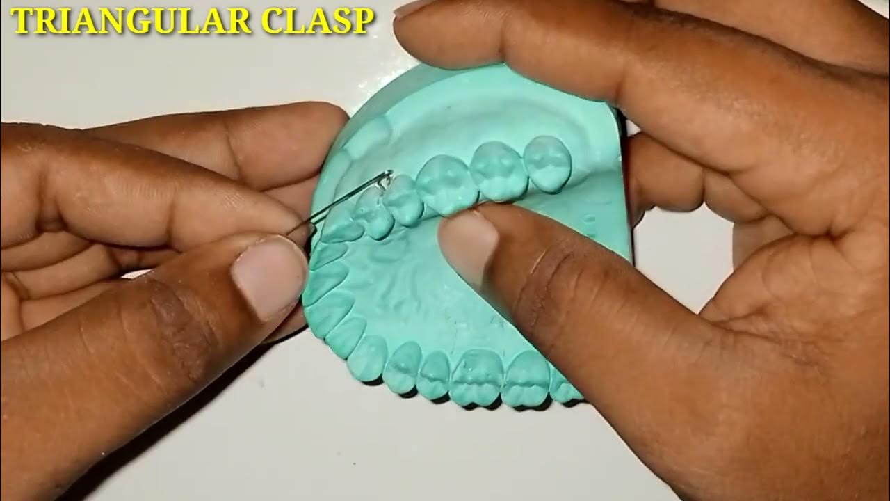 Triangular clasp YouTube