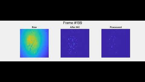 Neuronal activity from a miniscope recording