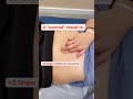 How to check yourself for separated abs (diastasis recti, DRA)