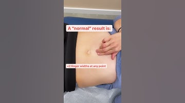 How to check yourself for separated abs (diastasis recti, DRA)