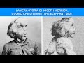 La Vera Storia di Joseph Merrick: l’Uomo che divenne “The Elephant Man”