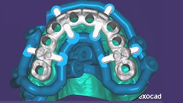Advanced Surgical Guides - DEMO