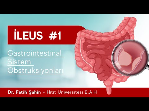 ILEUS  #1 - Dr. Fatih Şahin Anlatıyor