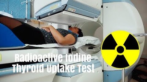 Radioactive Iodine Thyroid  Uptake Scan⎮#FertilityFriday