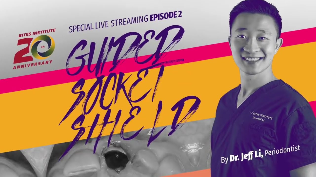 Guided Socket Shield - The New Gold Standard For The Aesthetic Anterior Implant