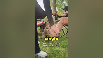 Feet After a 100 Mile Marathon (@BrockCovington)