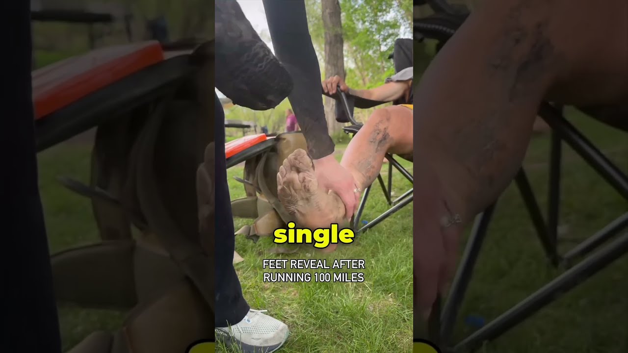 Feet After A 100 Mile Marathon BrockCovington 