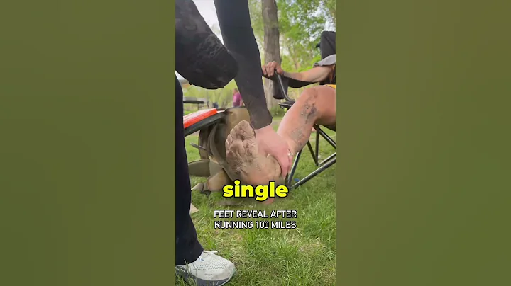Feet After a 100 Mile Marathon (@BrockCovington)