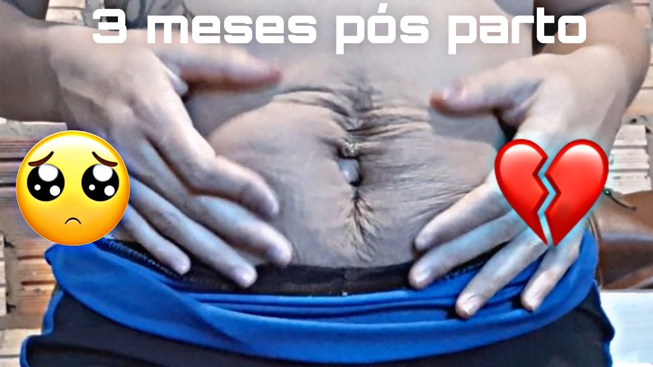 Meu corpo 3 meses pós parto ( cesariana ) - YouTube