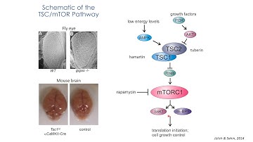 ITSCRC2021: First steps in gene therapy for Tuberous Sclerosis Complex