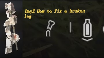 DayZ Console Xbox How to fix a Broken leg with no rags ASMR BigL