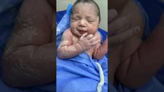 Newborn Reflexes