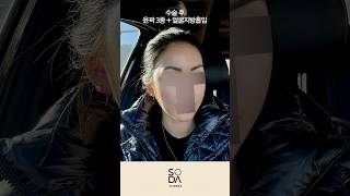 [SODA] 소다성형외과ㅣ윤곽3종 + 얼굴지방흡입 #shorts #쇼츠 #성형전후 #윤곽3종 #얼굴지방흡입