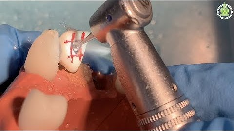 Preclinical laboratory demonstration - Anterior Access Cavity Preparation