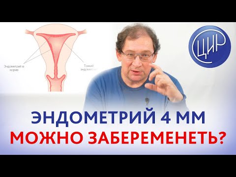 Тонкий эндометрий 4 мм. Можно ли забеременеть, если тонкий эндометрий? Отвечает Гузов И.И.