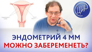 Тонкий эндометрий - 4 мм. Можно ли забеременеть, если тонкий эндометрий? Отвечает Гузов И.И.