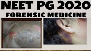 NEET- PG 2020 | FORENSIC MEDICINE | Exam Analysis | Memory based question with answer | BD