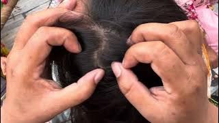 #nitsremoval 🥹lices removed from husband long wife || how to remove lices