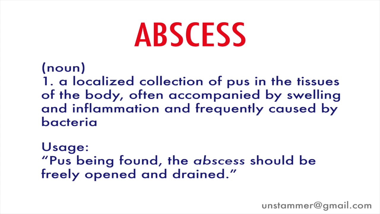 How to Pronounce Abscess YouTube