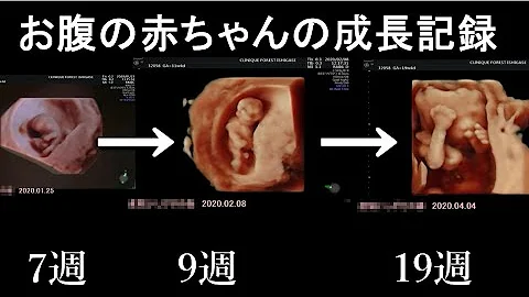 妊娠お腹の成長 Mp3