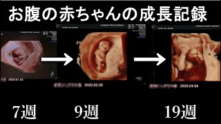 お腹の中の赤ちゃん 妊娠19週までの軌跡 Youtube お腹の中の赤ちゃん 妊娠19週までの軌跡 Youtube