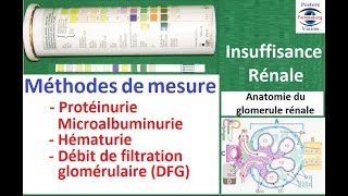 Méthodes de Mesure Protéinurie des 24h Hématurie sang dans les ...