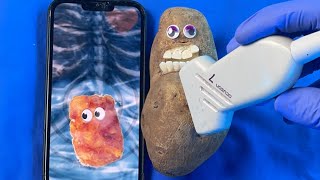 Potato Has C-Section Live! #Discountdentist #Fruitsurgery #Emergencysurgery #Satisfying #Asmr