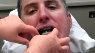 Dr Jean Wu - Delivery Of Sleep Apnea Appliance