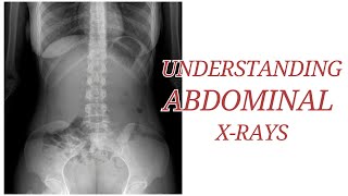 X-Ray abdomen। X-Ray abdomen plain। X-Ray abdomen erect screenshot 4