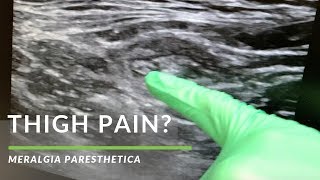 De meralgia de protocolo paresthetica fisioterapia