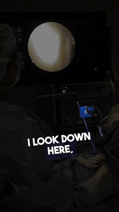 What Does A Shoulder Labrum Tear Look Like YouTube what-does-a-shoulder-labrum-tear-look-like-youtube