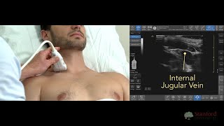Using Ultrasound to Examine Neck Veins (POCUS)