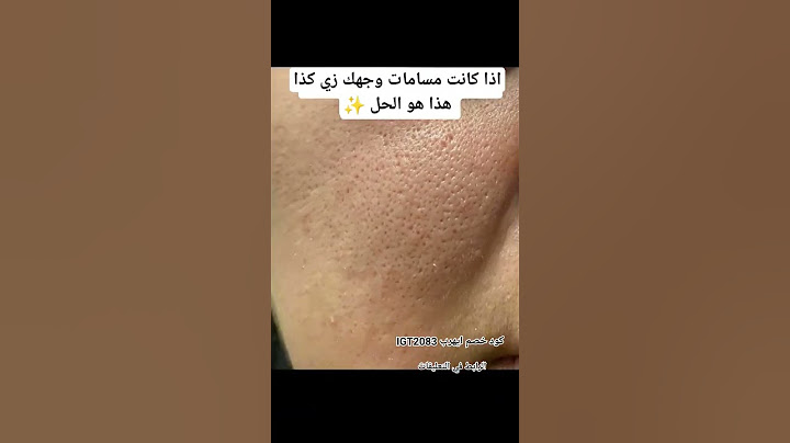 أفضل حل لغلق مسامات الوجه من ايهيرب ✨ #ايهيرب #عناية #عناية_بالبشرة #بشرة_صافية #iherb #skincare