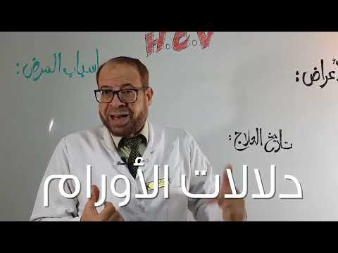 التهاب الكبد الوبائي فيروس بى دكتور جودة محمد عواد دكتور جودة محمد عواد