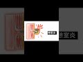 憩室炎放置すると　shorts 20