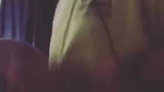 Amputee