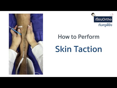 วีดีโอ: 3 วิธีในการทา Skin Traction