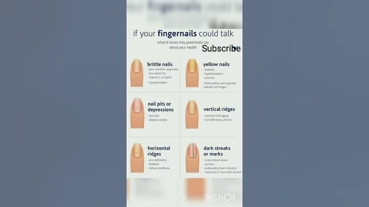 If your fingernails could talk #shorts#healthcare